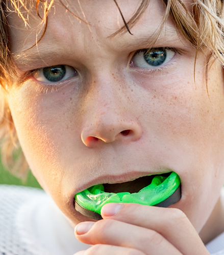 Young boy placing a green athletic mouthguard over his teeth