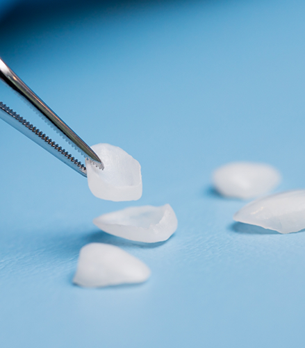 Tweezers holding a veneer