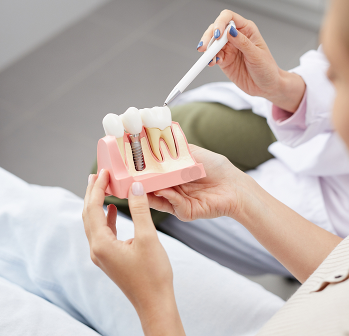 Dentist showing a patient a model of a dental implant in Independence