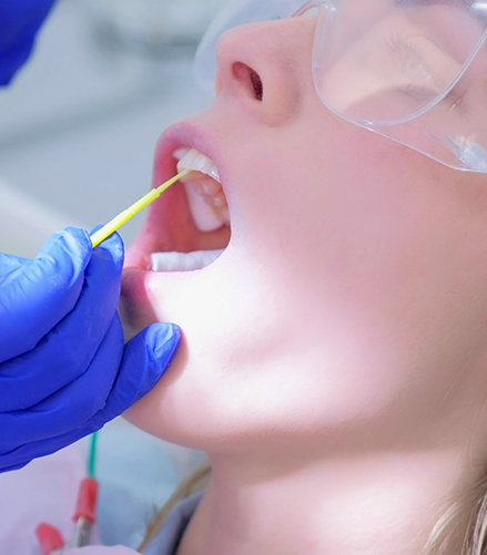 Dental patient having fluoride applied to their teeth