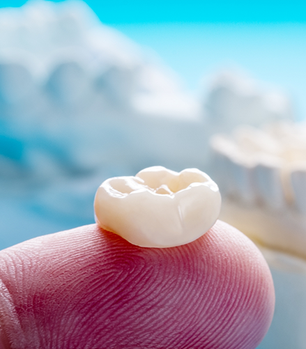 Dental crown resting on a finger